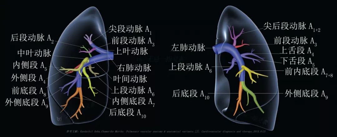 肺栓塞 CT 不会读?看完这篇文章轻松入门! 肺栓塞 CT 不会读?看完这篇文章轻松入门!