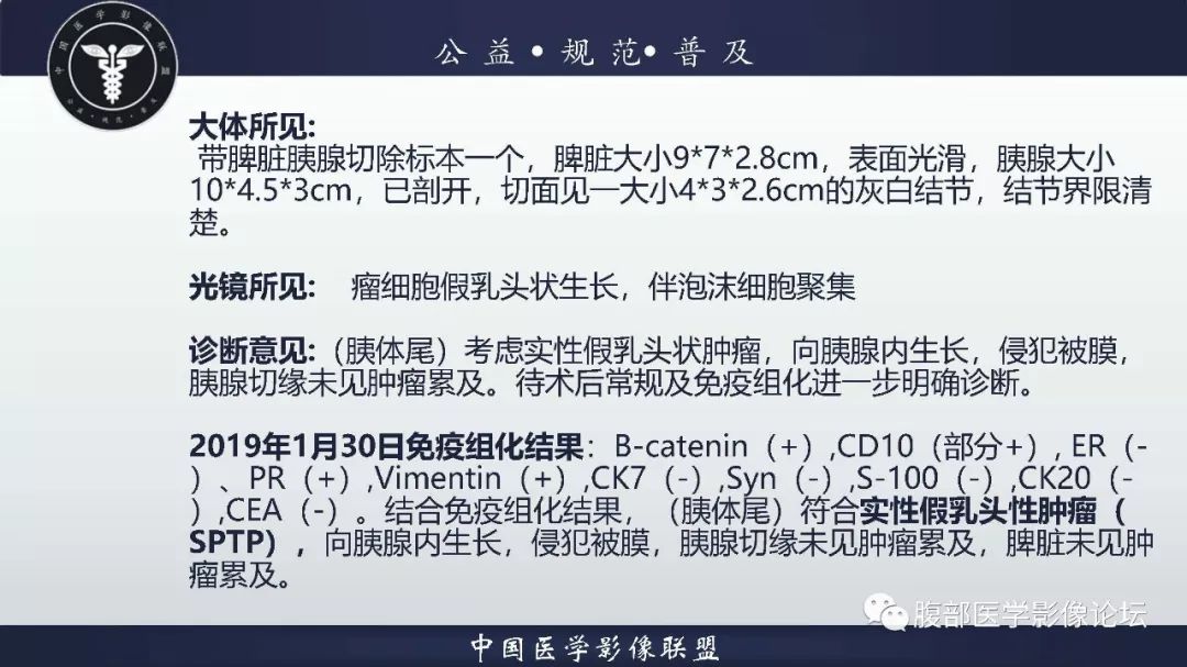 【病例】胰体尾实性假乳头状肿瘤1例CT及MR影像