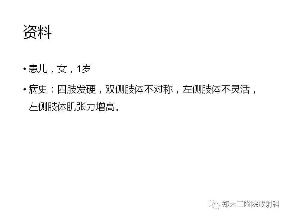 【病例】脑裂畸形3例MR影像解读