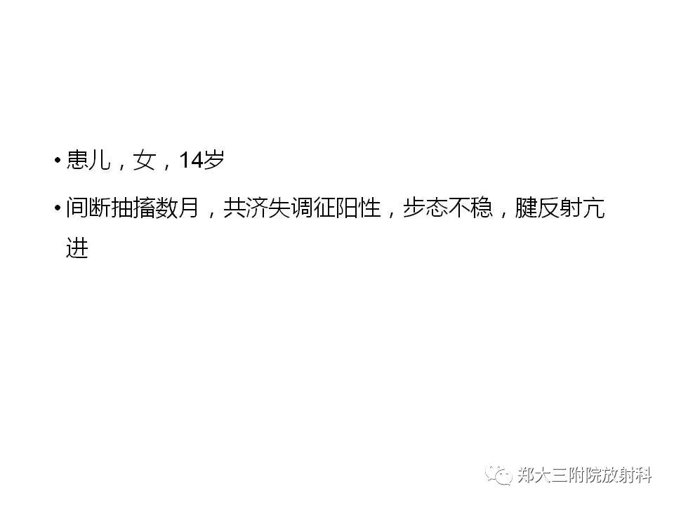 【病例】脑裂畸形3例MR影像解读