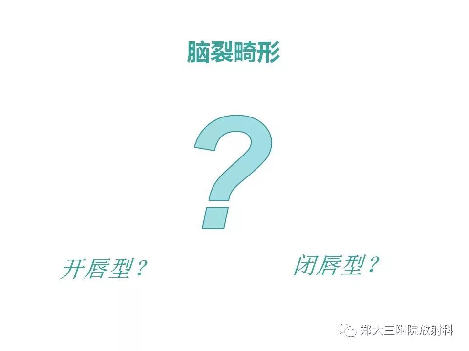 【病例】脑裂畸形3例MR影像解读
