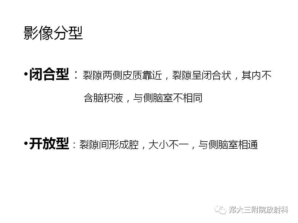 【病例】脑裂畸形3例MR影像解读