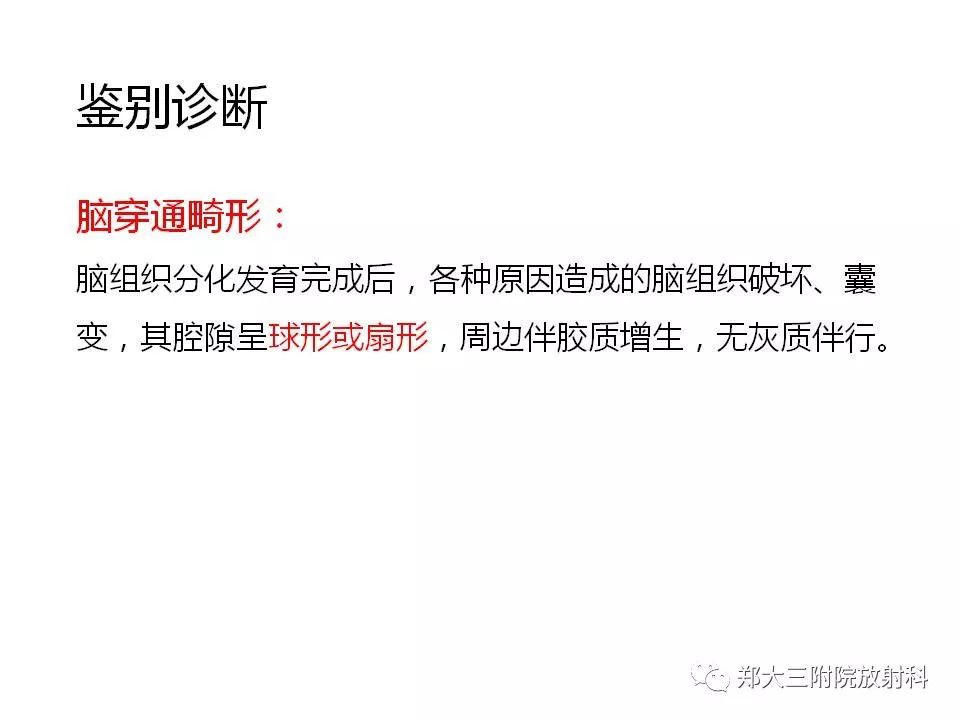 【病例】脑裂畸形3例MR影像解读
