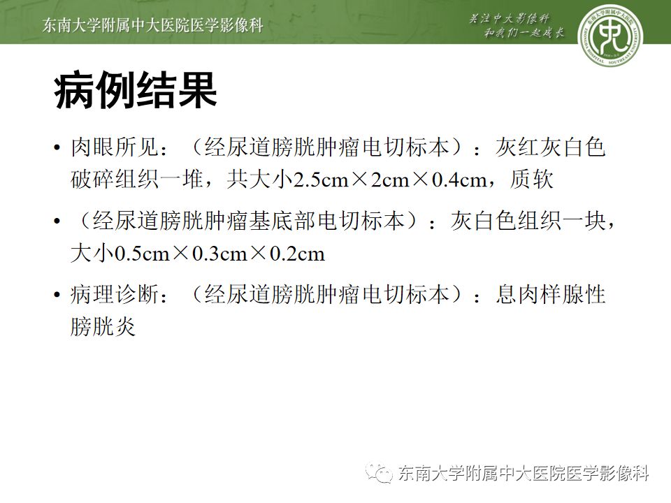 【病例】腺性膀胱炎1例CT影像