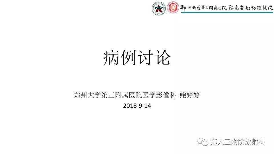 【病例】卵泡膜瘤1例CT影像