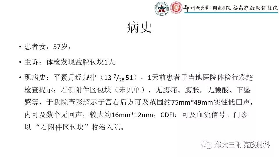 【病例】卵泡膜瘤1例CT影像