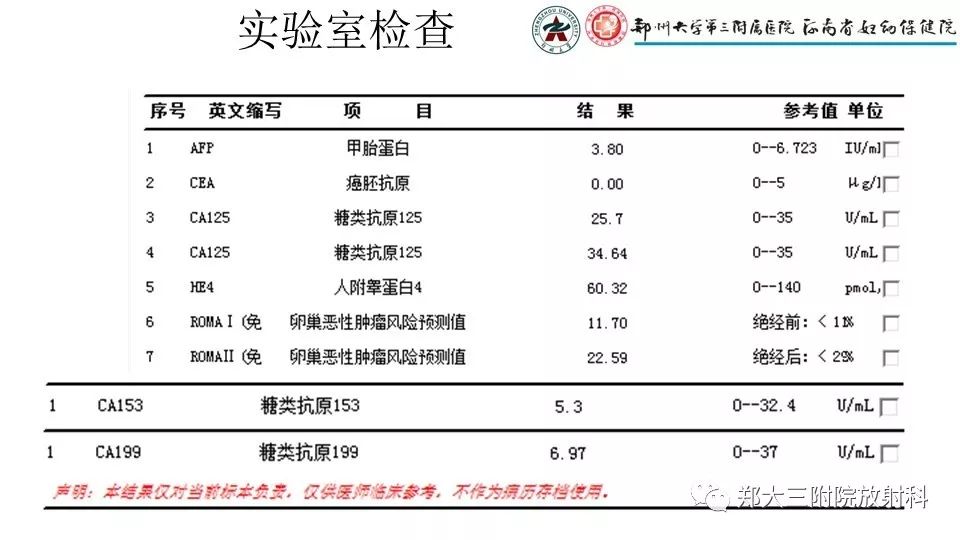 【病例】卵泡膜瘤1例CT影像