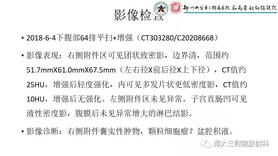 【病例】卵泡膜瘤1例CT影像