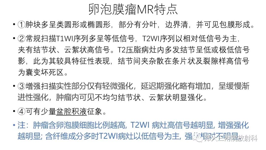 【病例】卵泡膜瘤1例CT影像