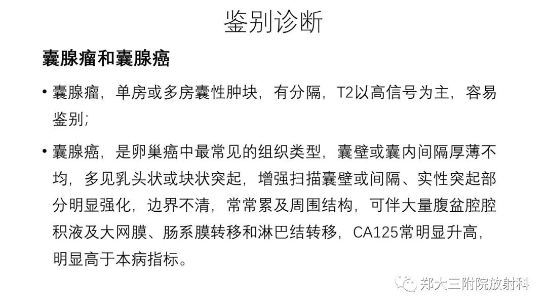 【病例】卵泡膜瘤1例CT影像