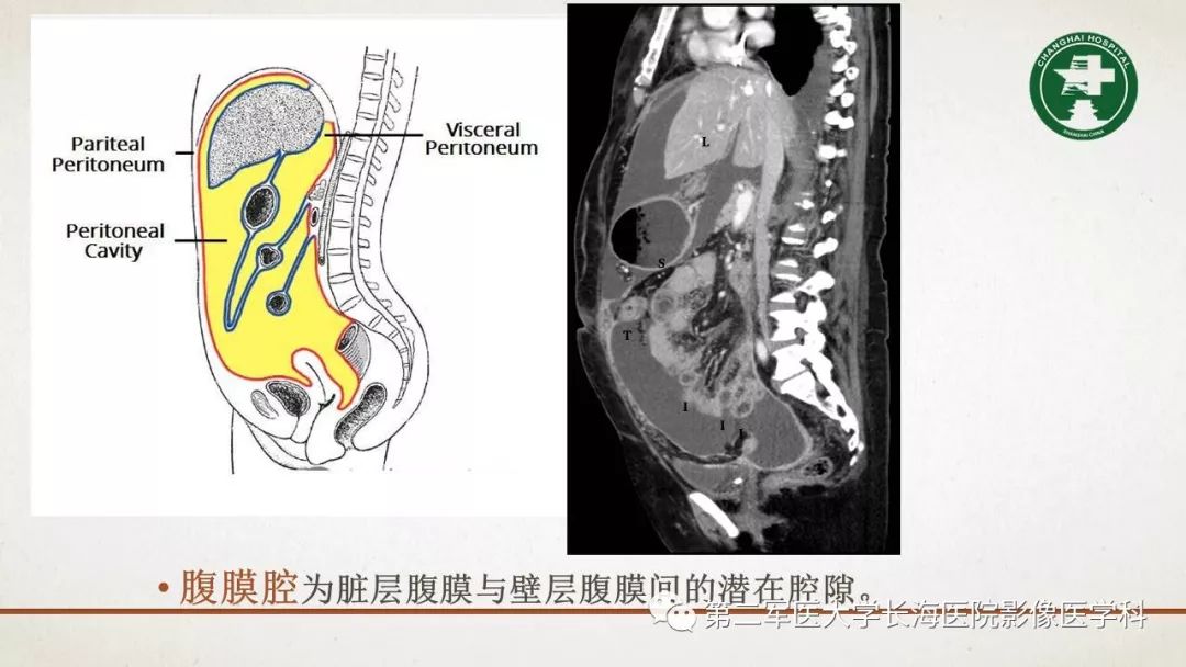 【PPT】腹膜相关结构的影像解剖