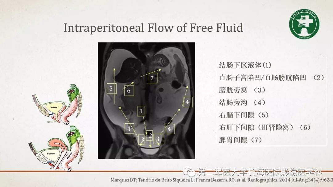【PPT】腹膜相关结构的影像解剖