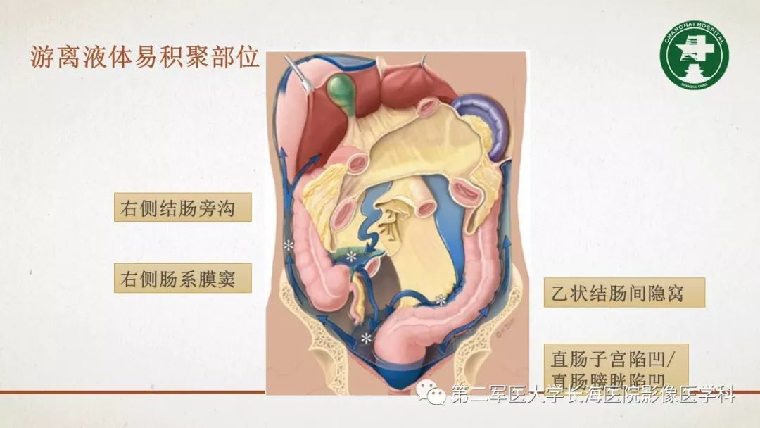 【PPT】腹膜相关结构的影像解剖