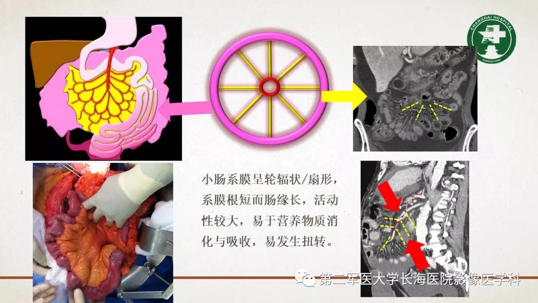 【PPT】腹膜相关结构的影像解剖
