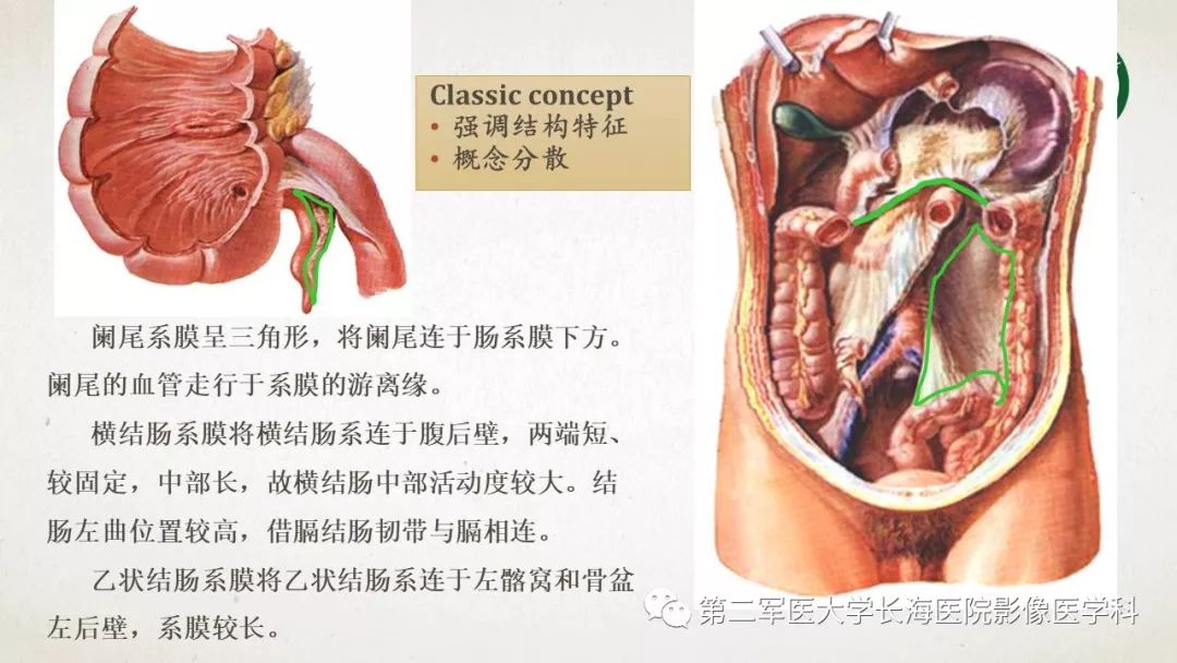 【PPT】腹膜相关结构的影像解剖