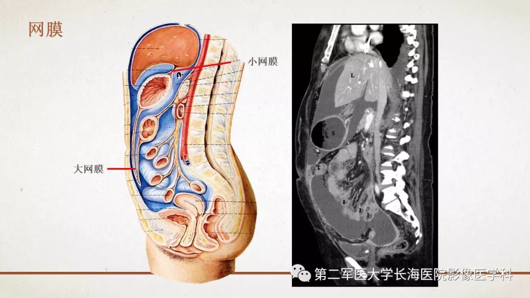 【PPT】腹膜相关结构的影像解剖