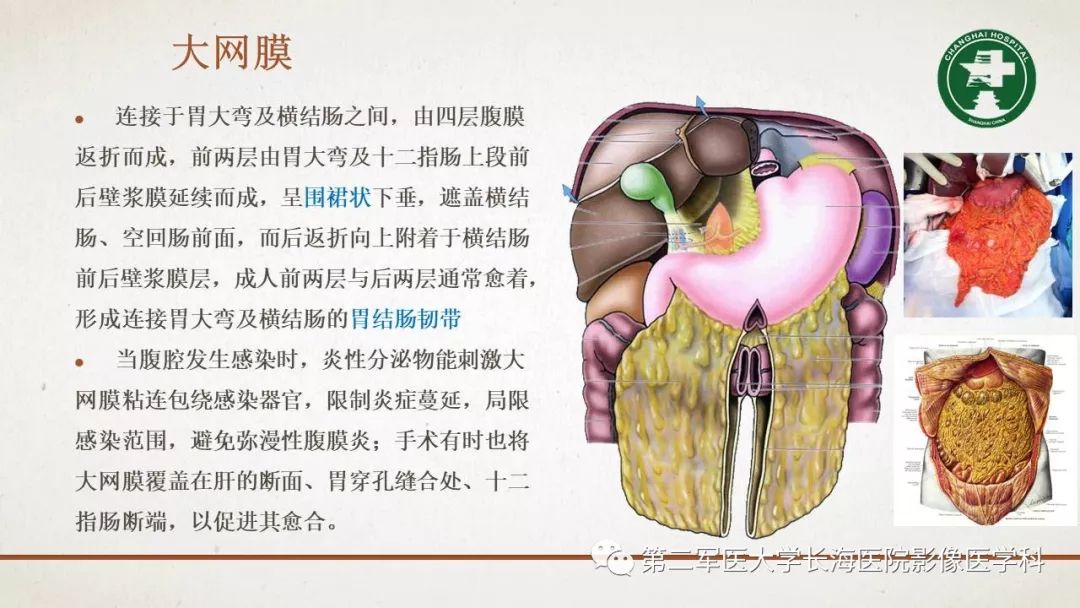 【PPT】腹膜相关结构的影像解剖