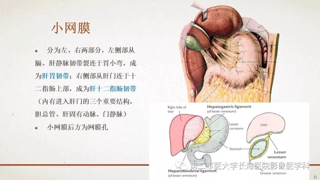 【PPT】腹膜相关结构的影像解剖