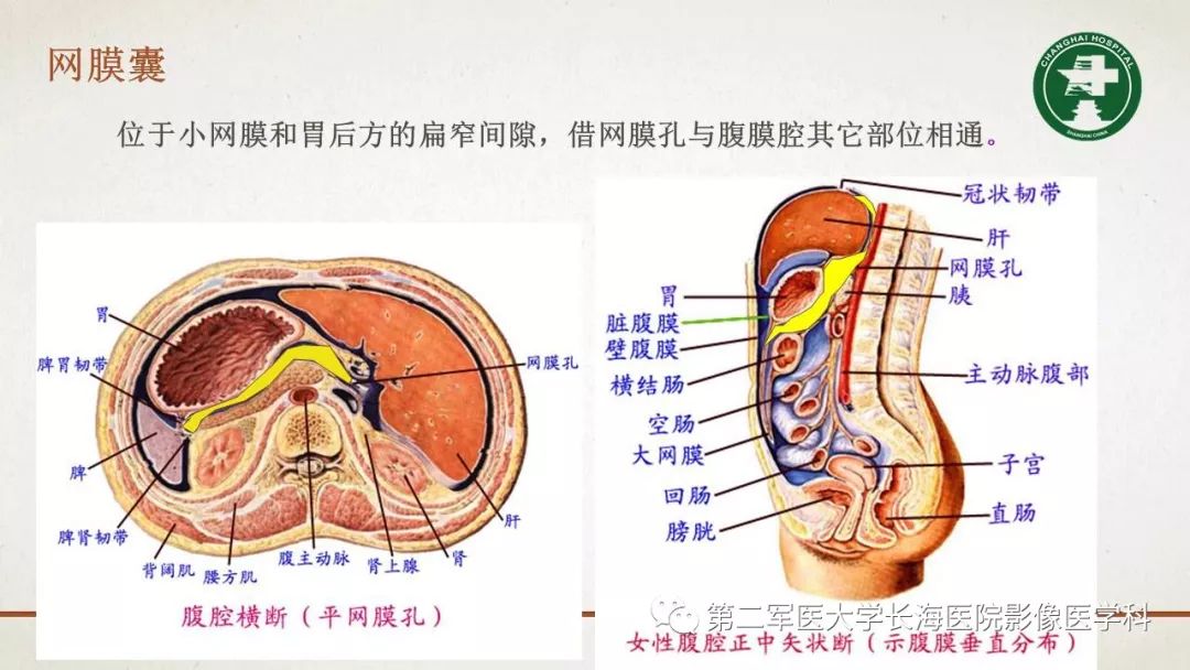 【PPT】腹膜相关结构的影像解剖
