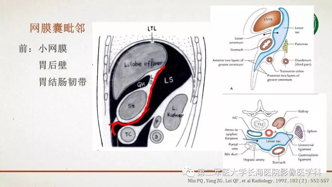 【PPT】腹膜相关结构的影像解剖