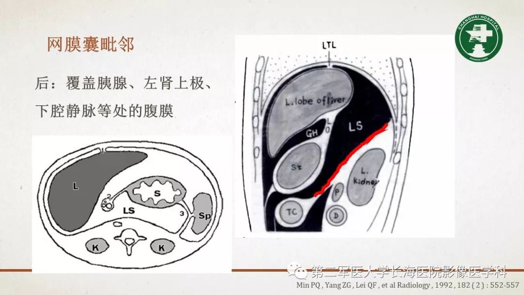 【PPT】腹膜相关结构的影像解剖