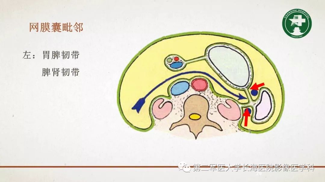 【PPT】腹膜相关结构的影像解剖