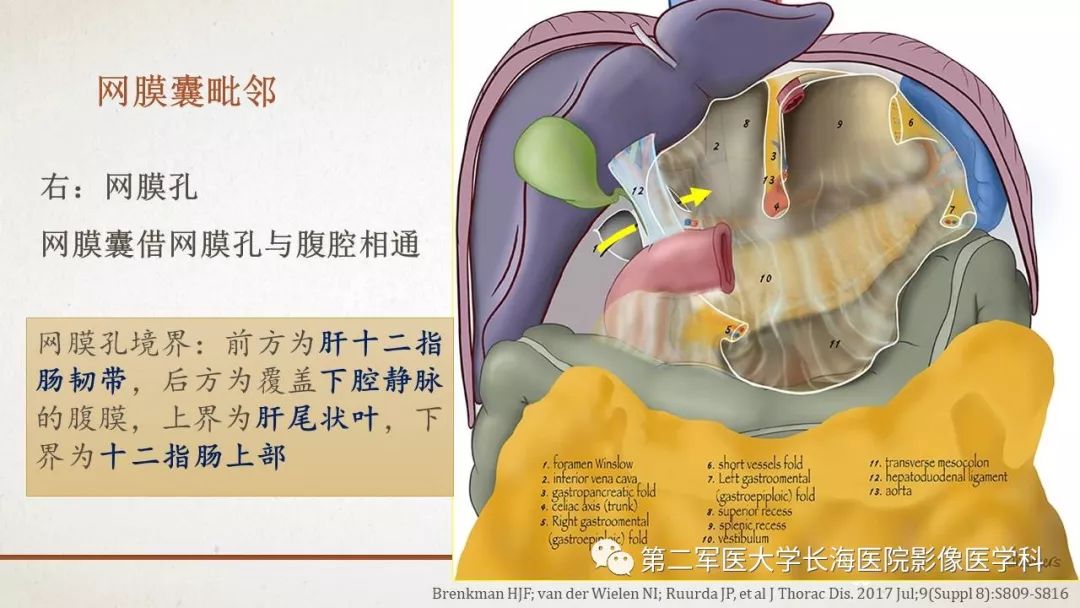 【PPT】腹膜相关结构的影像解剖
