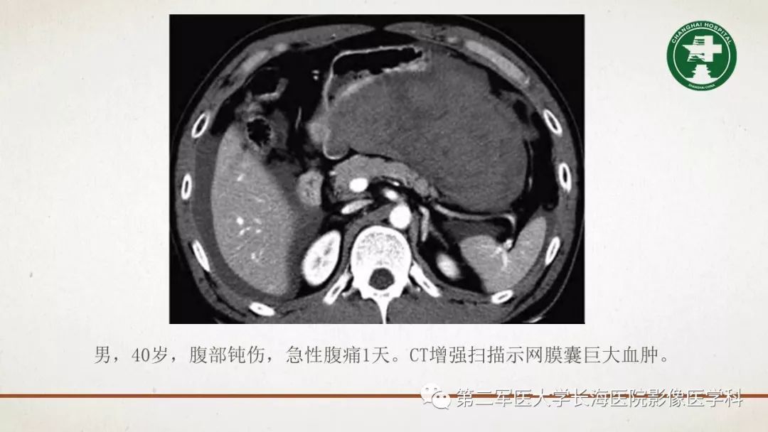 【PPT】腹膜相关结构的影像解剖