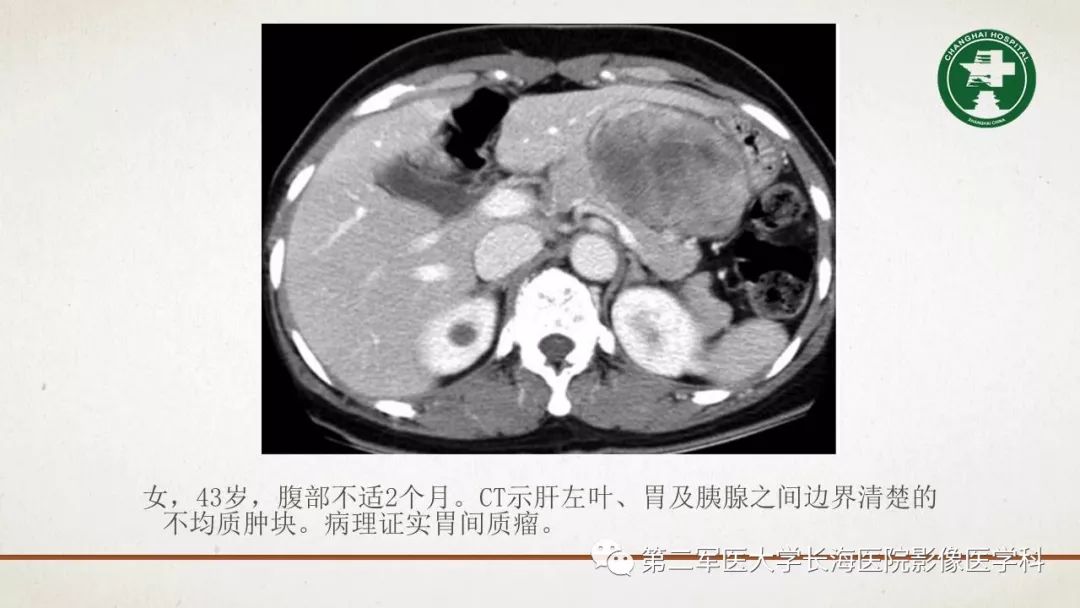 【PPT】腹膜相关结构的影像解剖