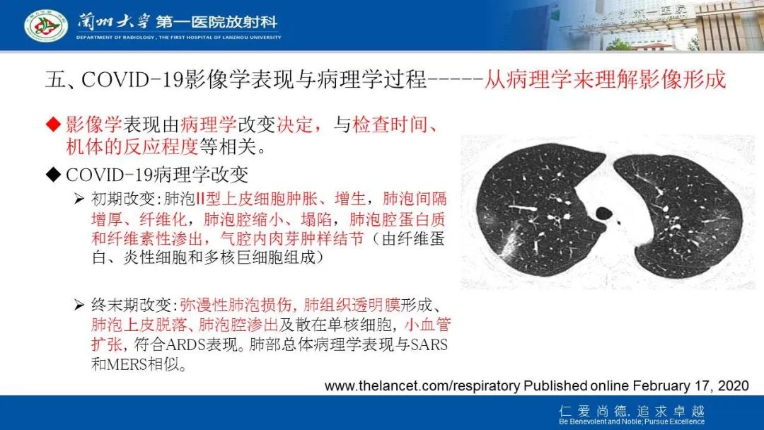【PPT】新冠肺炎（COVID-19，SARS-CoV2）学习