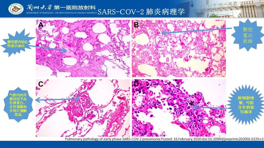 【PPT】新冠肺炎（COVID-19，SARS-CoV2）学习