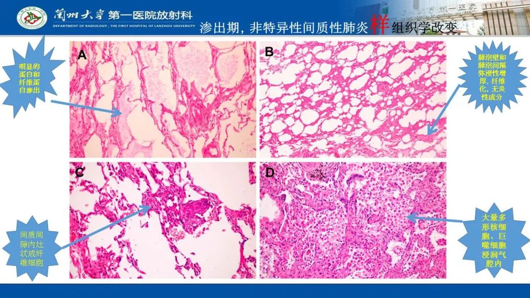 【PPT】新冠肺炎（COVID-19，SARS-CoV2）学习