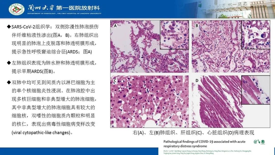 【PPT】新冠肺炎（COVID-19，SARS-CoV2）学习