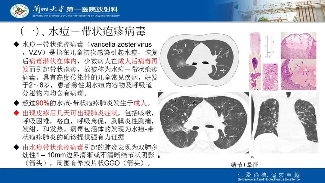 【PPT】新冠肺炎（COVID-19，SARS-CoV2）学习