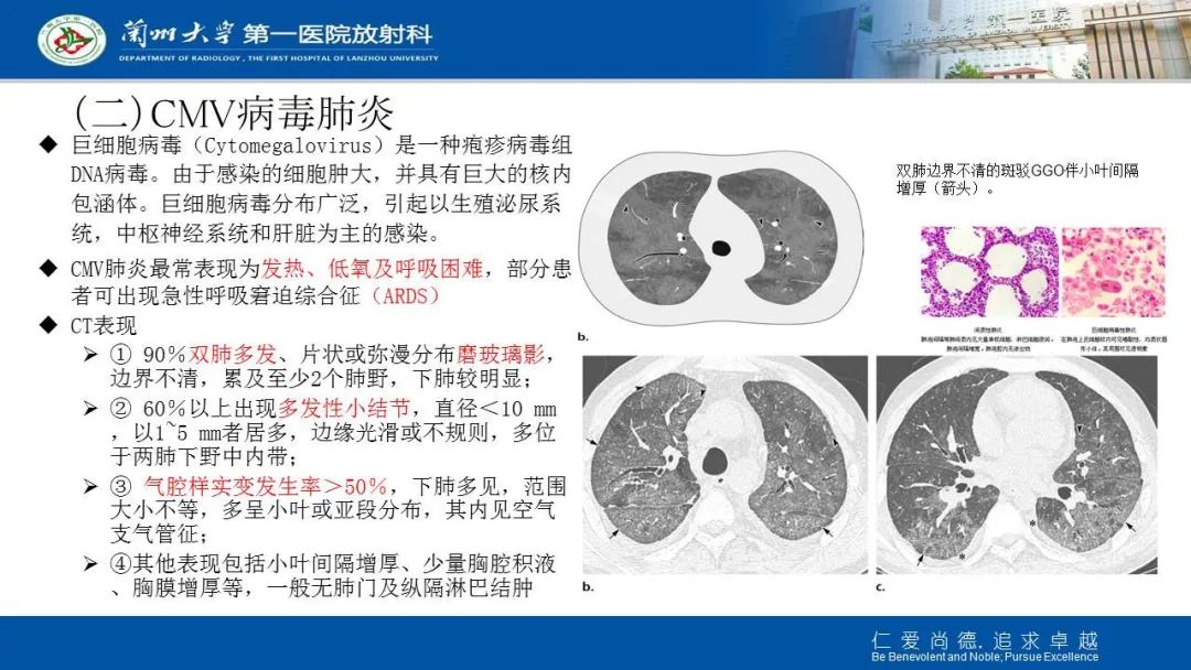 【PPT】新冠肺炎（COVID-19，SARS-CoV2）学习