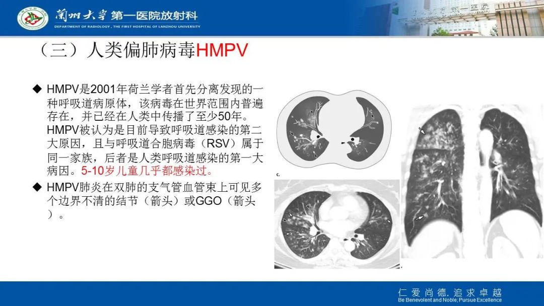 【PPT】新冠肺炎（COVID-19，SARS-CoV2）学习