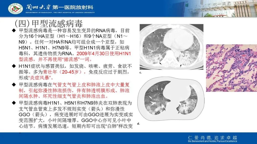 【PPT】新冠肺炎（COVID-19，SARS-CoV2）学习