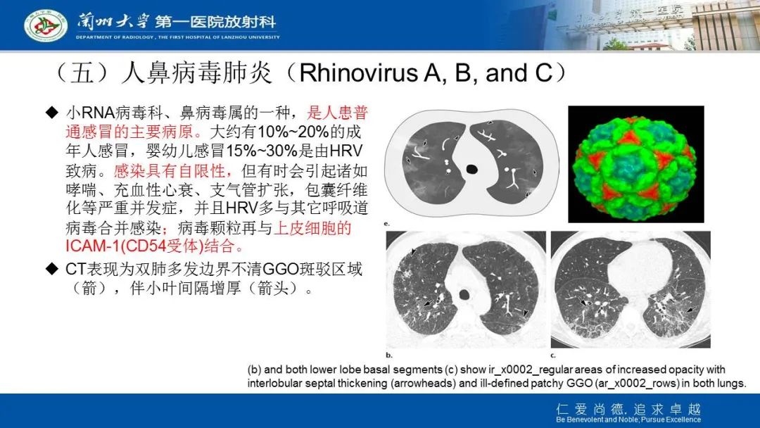 【PPT】新冠肺炎（COVID-19，SARS-CoV2）学习