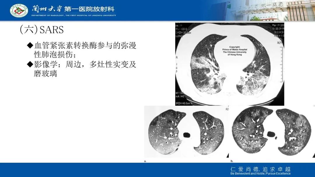【PPT】新冠肺炎（COVID-19，SARS-CoV2）学习
