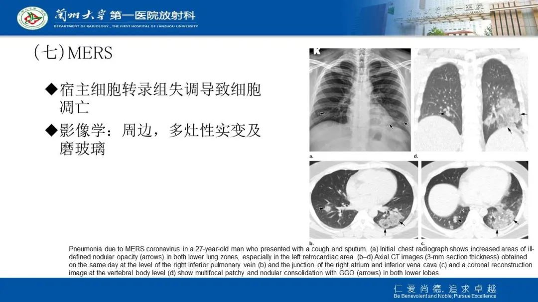 【PPT】新冠肺炎（COVID-19，SARS-CoV2）学习
