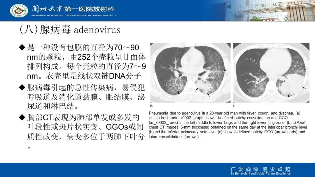【PPT】新冠肺炎（COVID-19，SARS-CoV2）学习