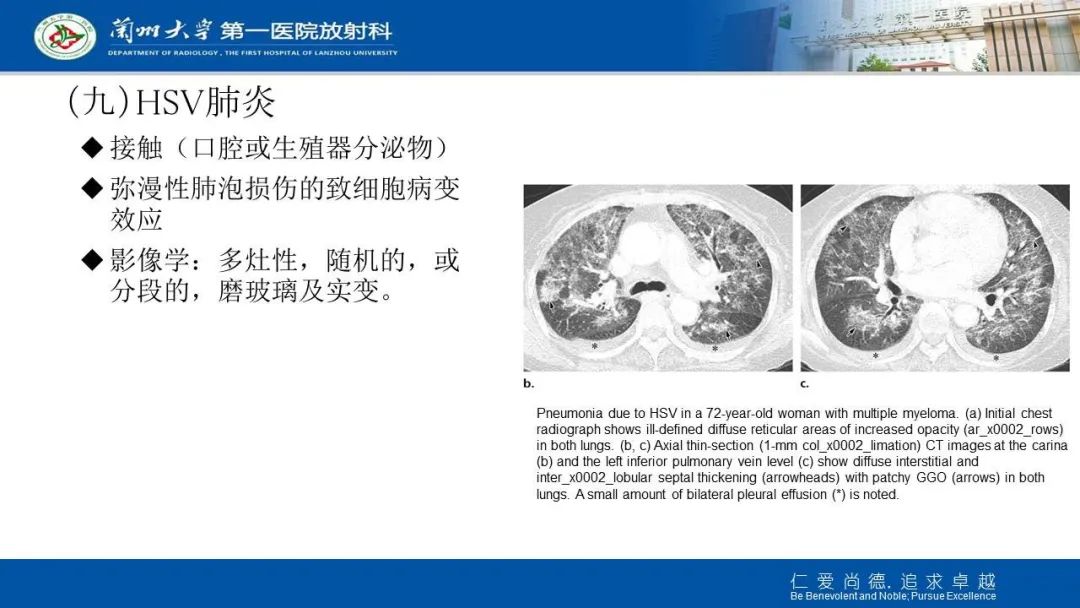 【PPT】新冠肺炎（COVID-19，SARS-CoV2）学习