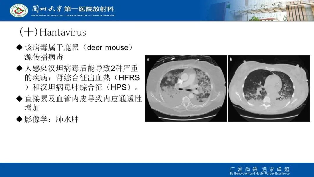 【PPT】新冠肺炎（COVID-19，SARS-CoV2）学习