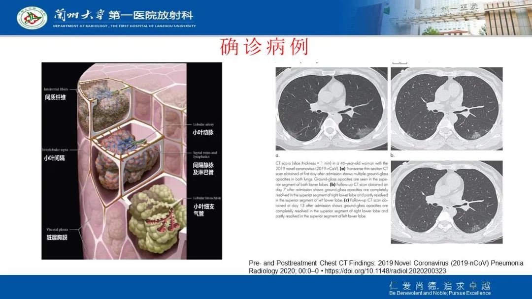 【PPT】新冠肺炎（COVID-19，SARS-CoV2）学习