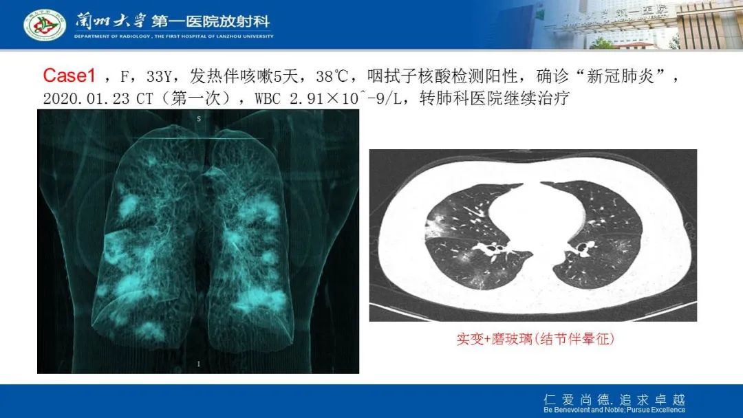 【PPT】新冠肺炎（COVID-19，SARS-CoV2）学习