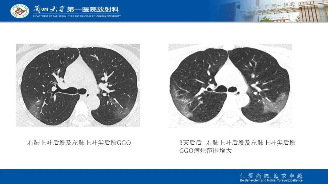 【PPT】新冠肺炎（COVID-19，SARS-CoV2）学习