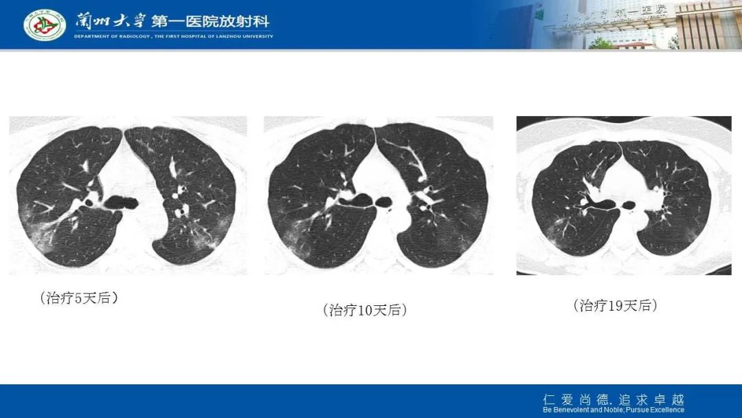 【PPT】新冠肺炎（COVID-19，SARS-CoV2）学习