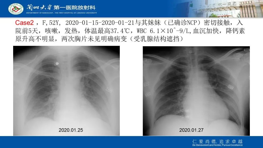 【PPT】新冠肺炎（COVID-19，SARS-CoV2）学习