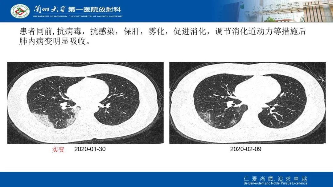 【PPT】新冠肺炎（COVID-19，SARS-CoV2）学习