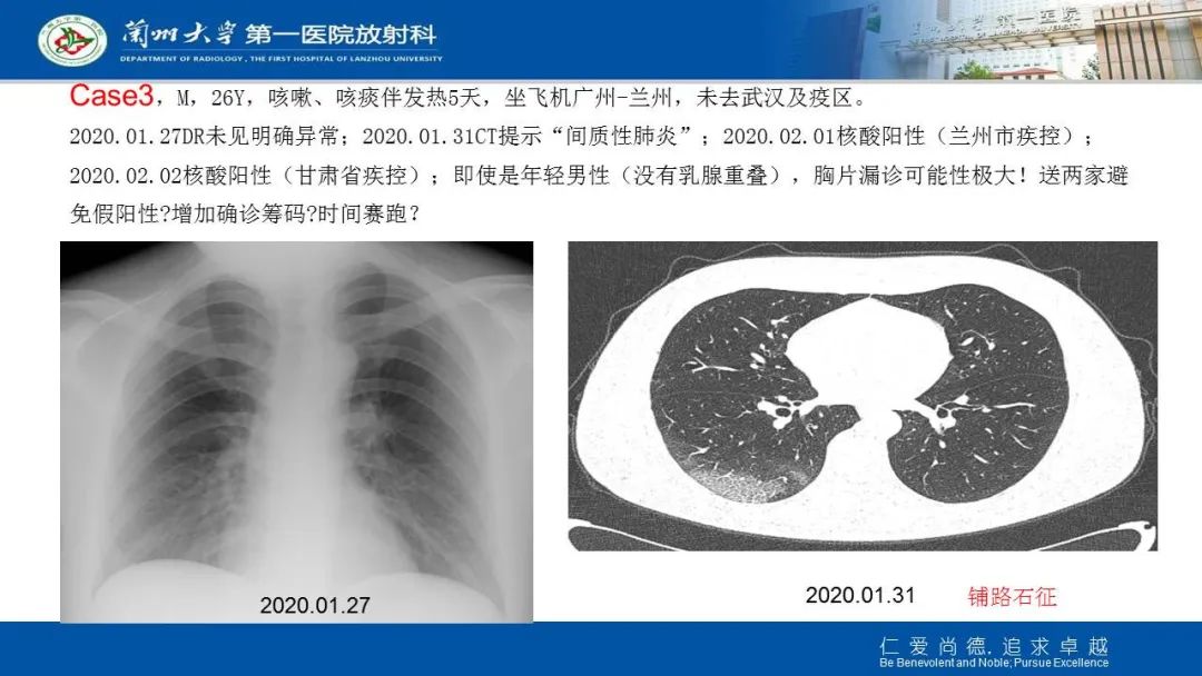 【PPT】新冠肺炎（COVID-19，SARS-CoV2）学习